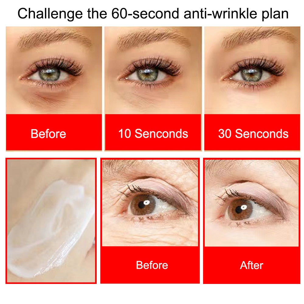 Retinol Eye Cream: Anti-Aging & Dark Circle Remover