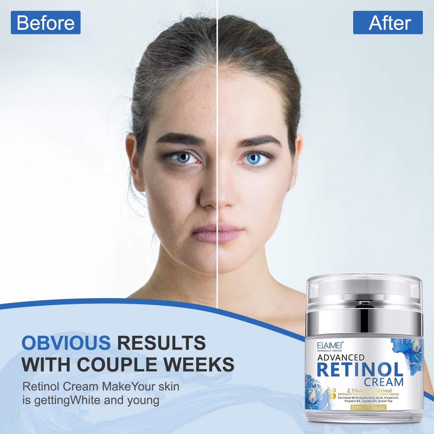 Retinol Face Cream, Anti-wrinkle, Anti-aging, Moisturizing, Hyaluronic Acid, Vitamin C, Face Whitening Cream