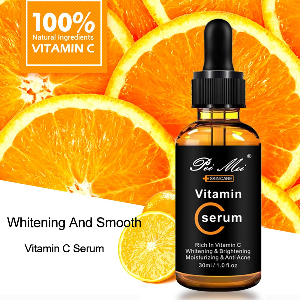 Vitamin C Serum: Brighten Skin, Lighten Spots (30ml)