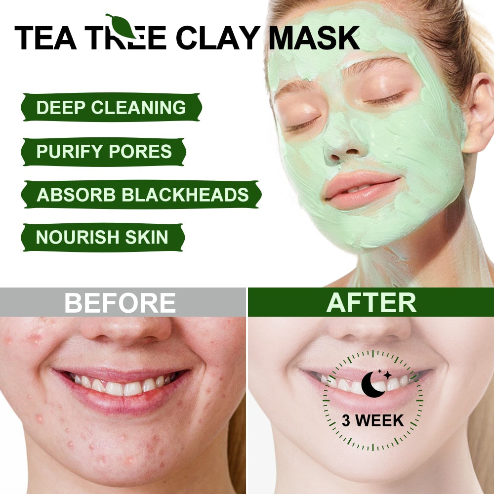 Acne Treatment Facial Mask Natural Tea Tree Pore Blackhead Oil Cleaner Skin Care