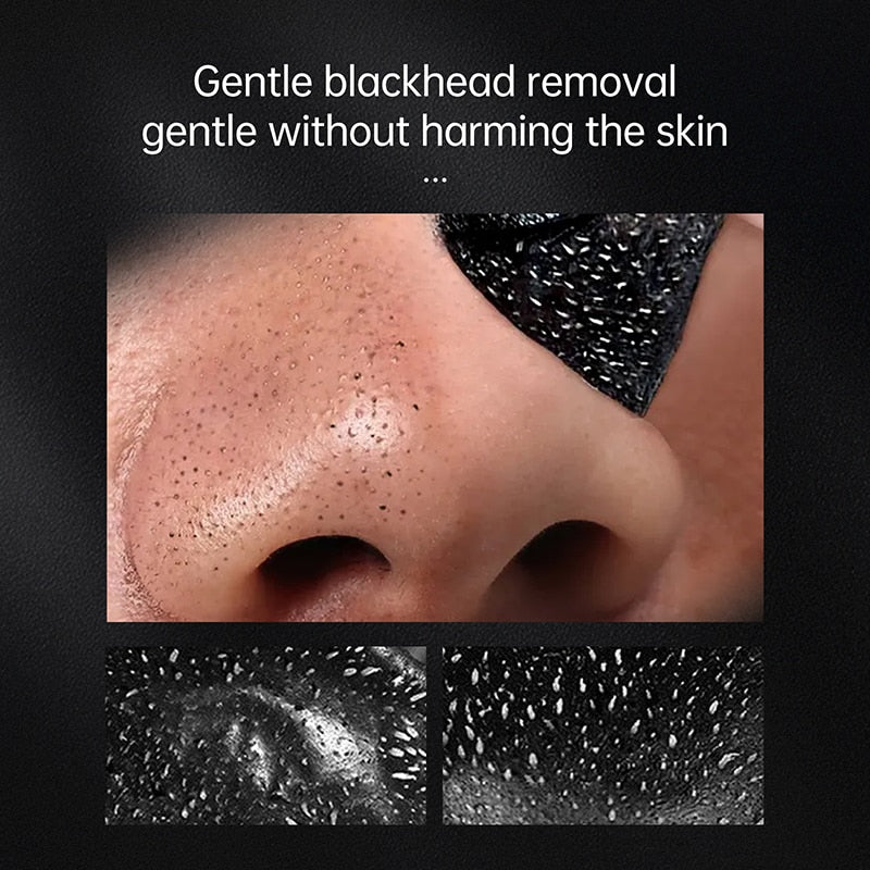 Blackhead Remover Black Dots Facial Masks Bamboo Charcoal Anti Acne