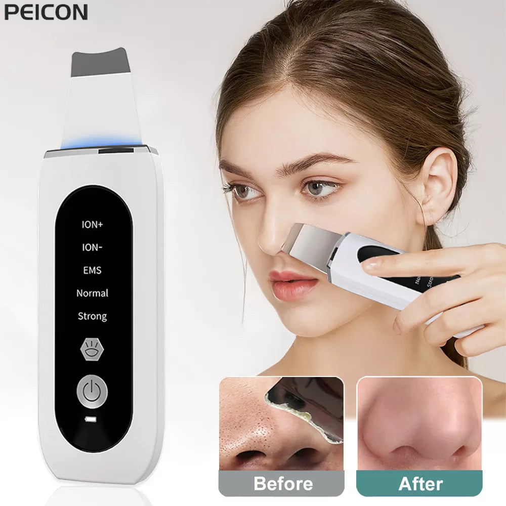 Ultrasonic Ion Skin Scrubber Blackhead Remover Deep Face Cleaning Acne Pore Cleaner Facial Shovel Cleanser