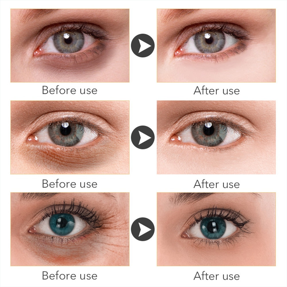 Remove Dark Circles Eye Serum, Eye Bags Brighten Eye Cream, Hyaluronic Acid