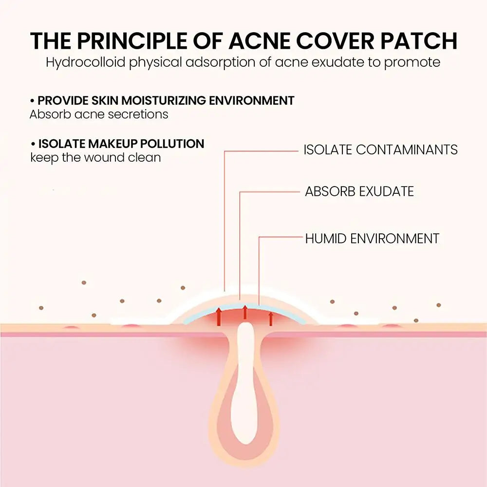 200 pcs Acne Pimple Patch Spot Sticker Face Skin Care Repair Acne Healing