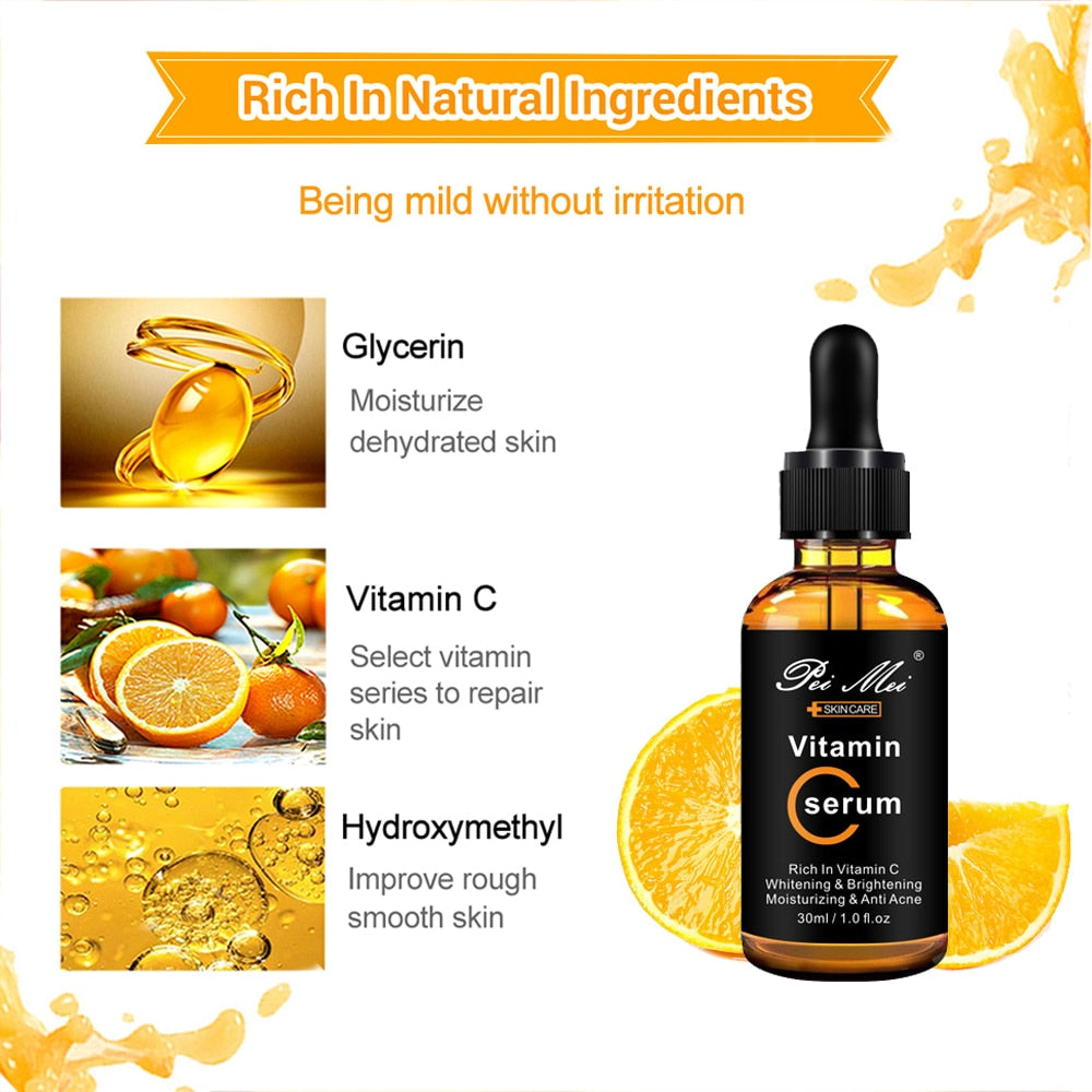 Vitamin C Serum: Brighten Skin, Lighten Spots (30ml)