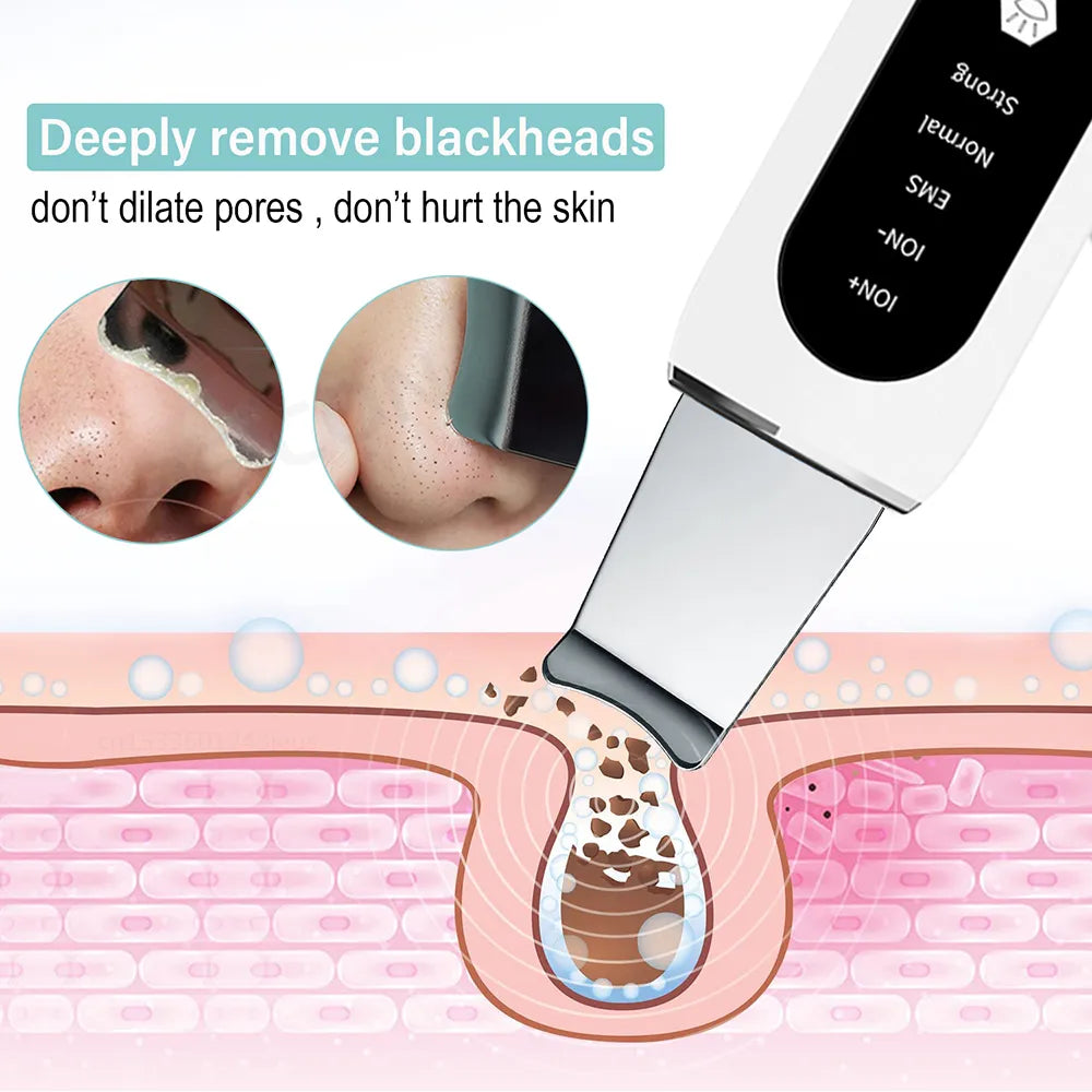 Ultrasonic Ion Skin Scrubber Blackhead Remover Deep Face Cleaning Acne Pore Cleaner Facial Shovel Cleanser