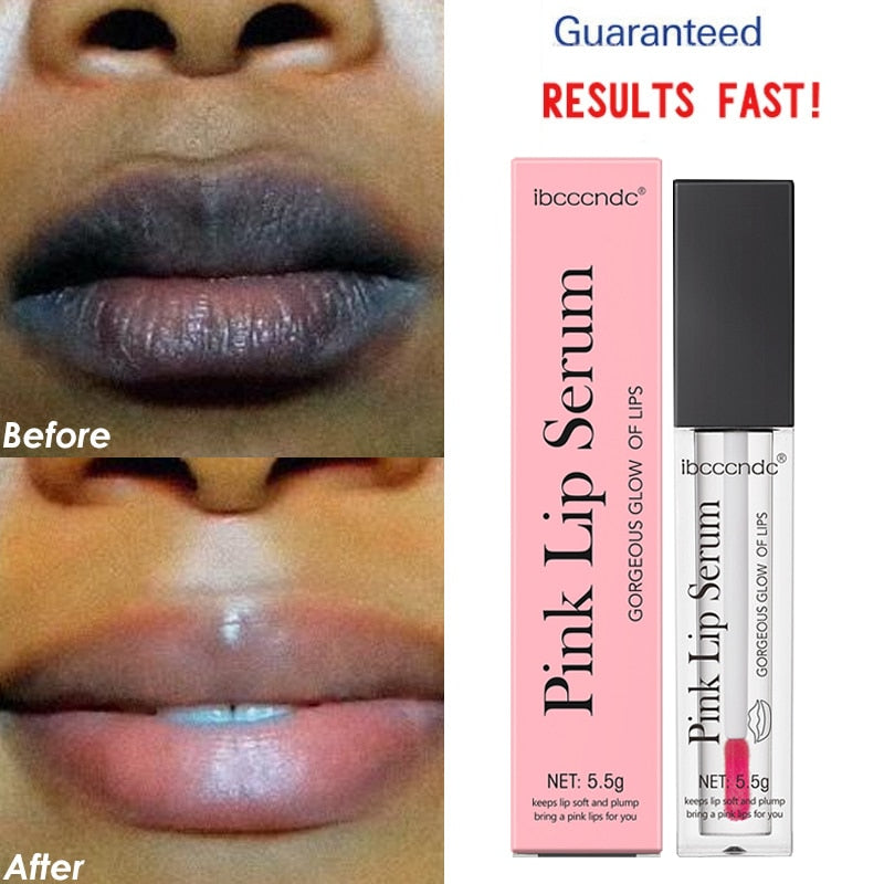 Lips Pink Bleaching Cream Remove Dark Smoke Lips