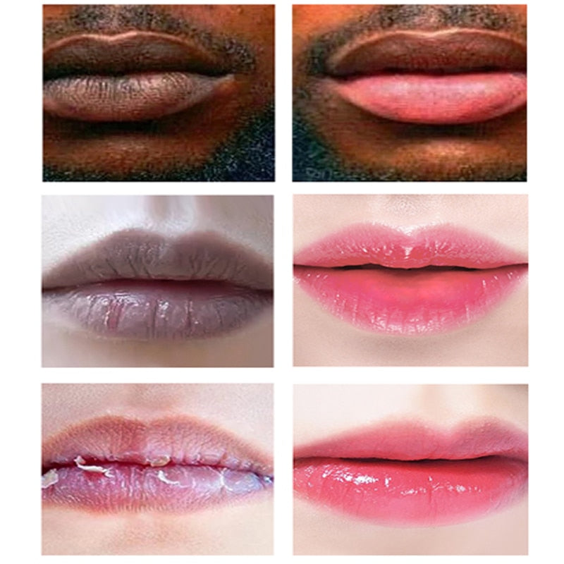 Lips Pink Bleaching Cream Remove Dark Smoke Lips