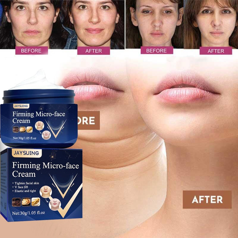 V-Shape Face Slimming Cream, Lift Double Chin, Cheek Slimming, Firming, Anti Wrinkle Skin Care